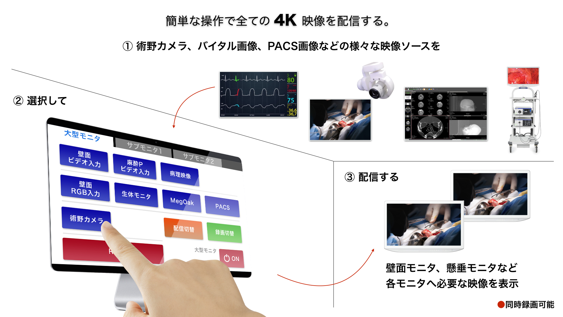 手術映像管理システム